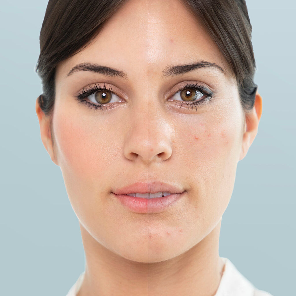 InnovaGoods Gesichtspflege-Set – Moispa Gesichtssauna und Pore·Off Porenreiniger